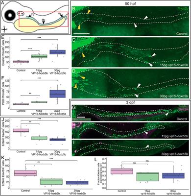 Elevated Hoxb5b Expands Vagal Neural Crest Pool and Blocks Enteric Neuronal Development in Zebrafish